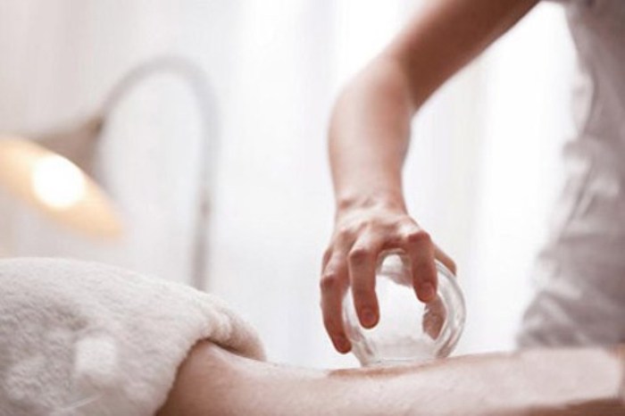 针灸排名_中医针灸图片(3)