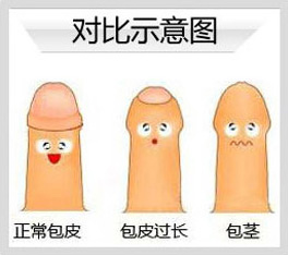 下面,我们就一起来了解一下 男性包皮过长和包茎症状有哪些.